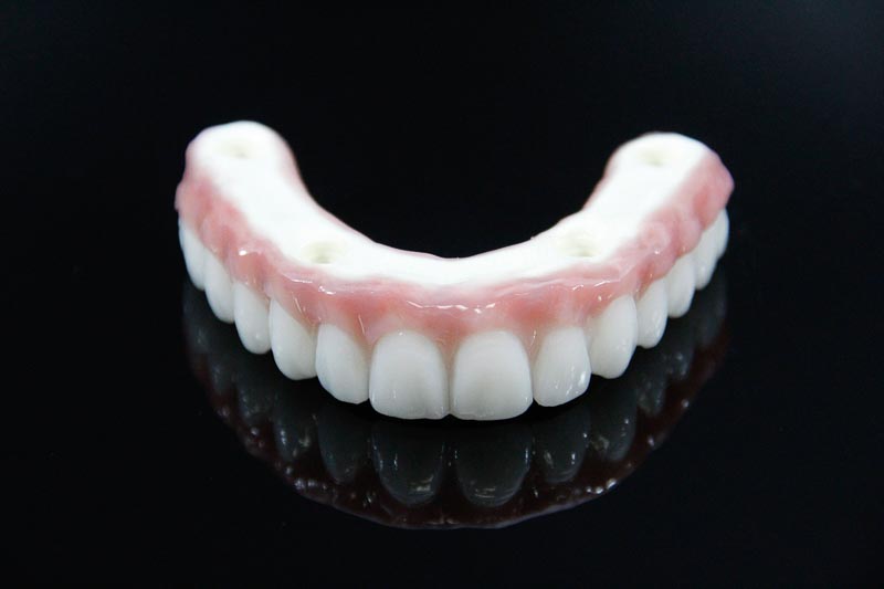 All on 4 Top Denture